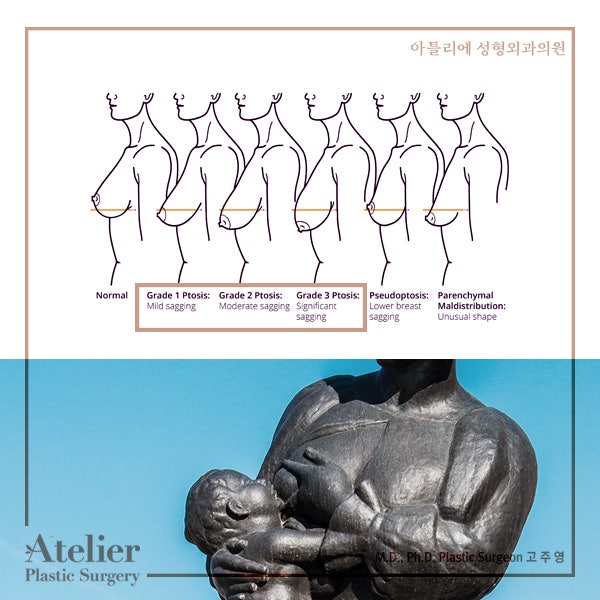 출산후 처진가슴 목욕탕가기 민망하다면 사진 7