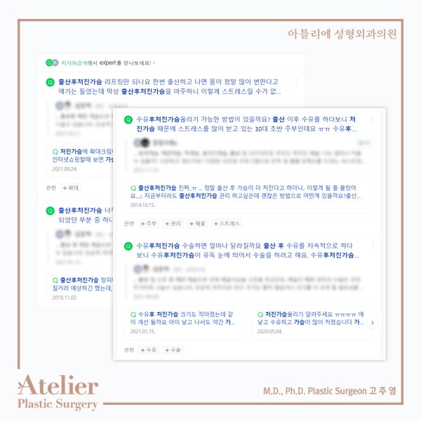 출산후 처진가슴 목욕탕가기 민망하다면