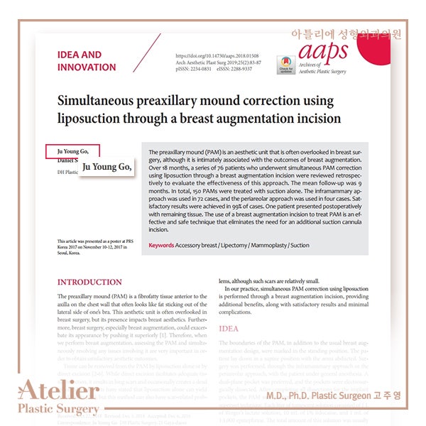 부유방제거 수술과 시술 중에서 고민한다면 사진 7
