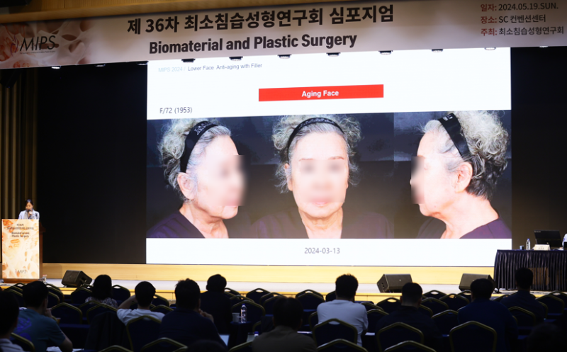 '필러 이용한 효과적 하안면 안티에이징' 주제발표 사진 4