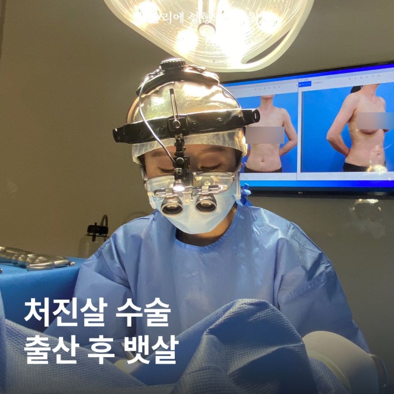 처진살 수술 복부거상 흉터 후기 찾고 있다면 확인하세요