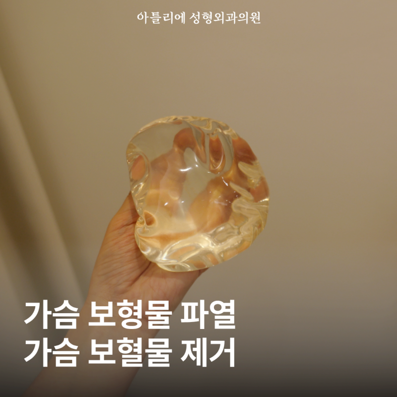 가슴 보형물 파열 증상 터짐 제거 수술 전 확인할 사항